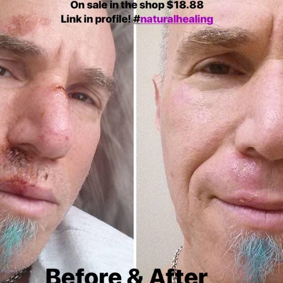 🌿Raven's Salve🌿 Multi-use healing balm - Picture 6 of 8